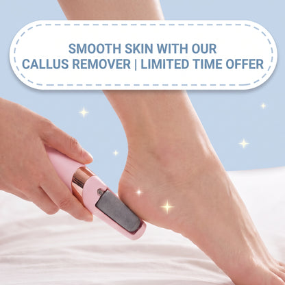 Dead-Skin Callus Remover