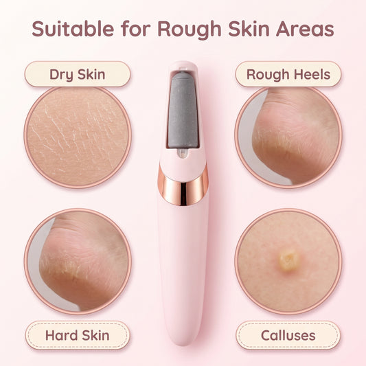 Dead-Skin Callus Remover